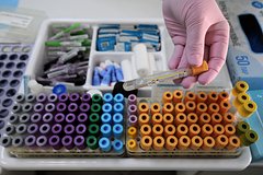 Eyni anda 25 infeksiyanı aşkar edə bilən test hazırlanıb