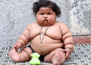 BMT: Dünyada artıq çəkili uşaqların sayı iki dəfə artıb