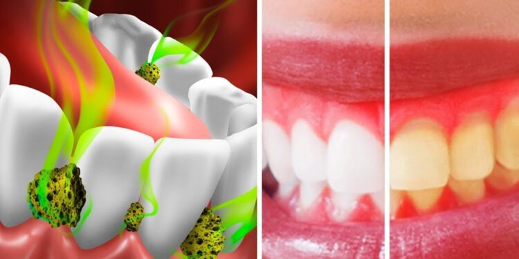 Ağız mikrobları xərçəng YARADIR