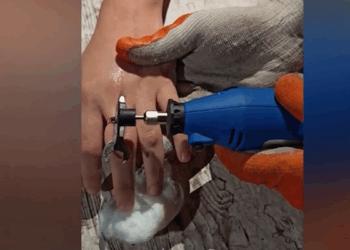 Qızın barmağında qalan üzüyü belə çıxardılar – VİDEO