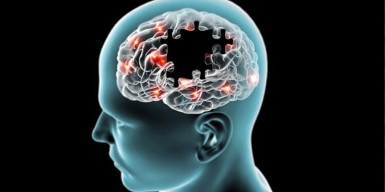 Qadınların beyinləri Alzheimer xəstəliyinə qarşı daha həssasdır - ARAŞDIRMA