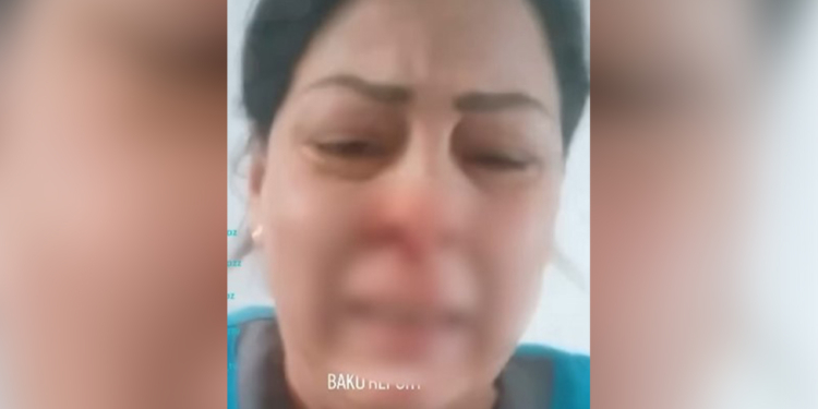 Xəstəxana direktoru işçini döyüb? - VİDEO