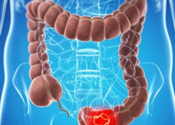 Ultra emal olunmuş qidalar xərçəng riskini ARTIRIR