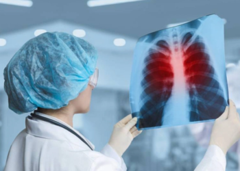 Azərbaycanda bu il vərəmə yoluxmada azalma müşahidə olunub – RƏSMİ