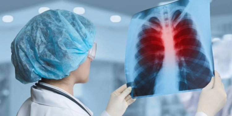 Azərbaycanda bu il vərəmə yoluxmada azalma müşahidə olunub - RƏSMİ