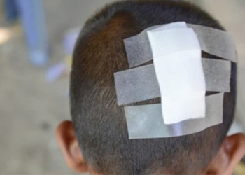 Hesaba görə kafe sahibi ilə mübahisədə – 6 yaşlı oğlu başından zərbə aldı