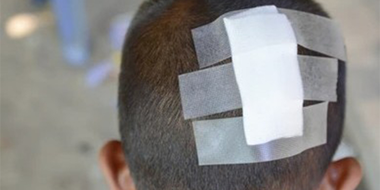 Hesaba görə kafe sahibi ilə mübahisədə - 6 yaşlı oğlu başından zərbə aldı