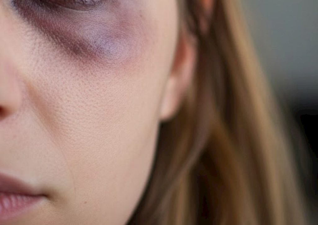 Bakıda aktyorun anası döyüldü — Təfərrüat