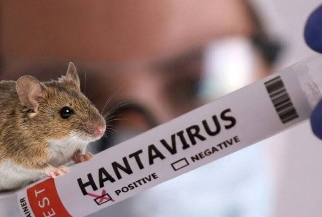 Bu epidemiya rəsmən BİTDİ